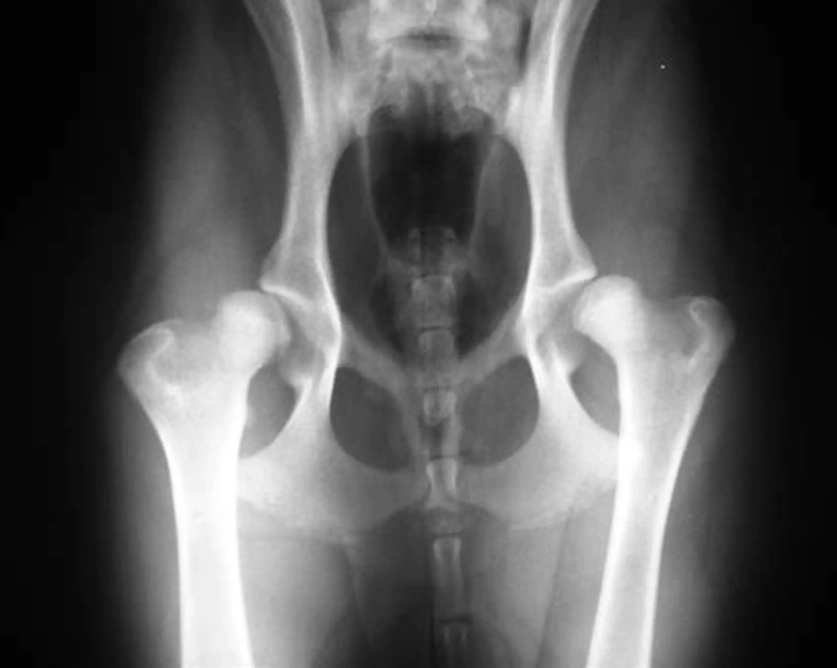 hip dysplasia symptoms
